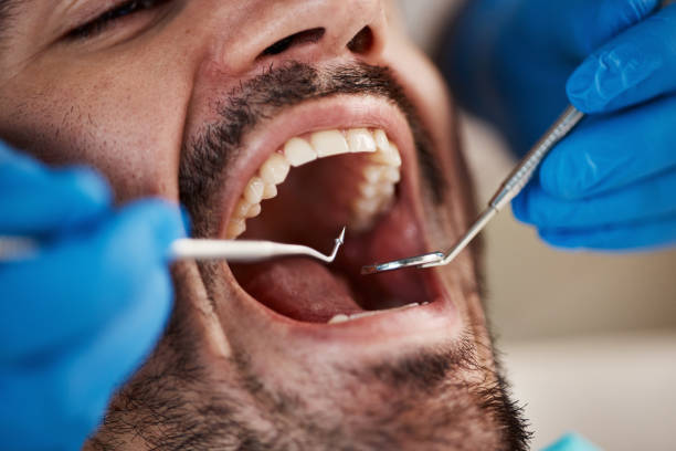 Tooth Infection Emergency Dentist in MO